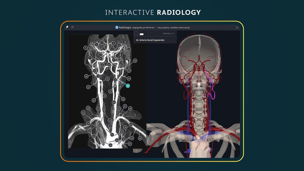 Interactive Radiology screen displaying two interior views of a head, neck and shoulders